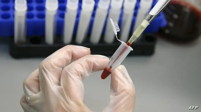 علاج خامس حالة من مرض الإيدز