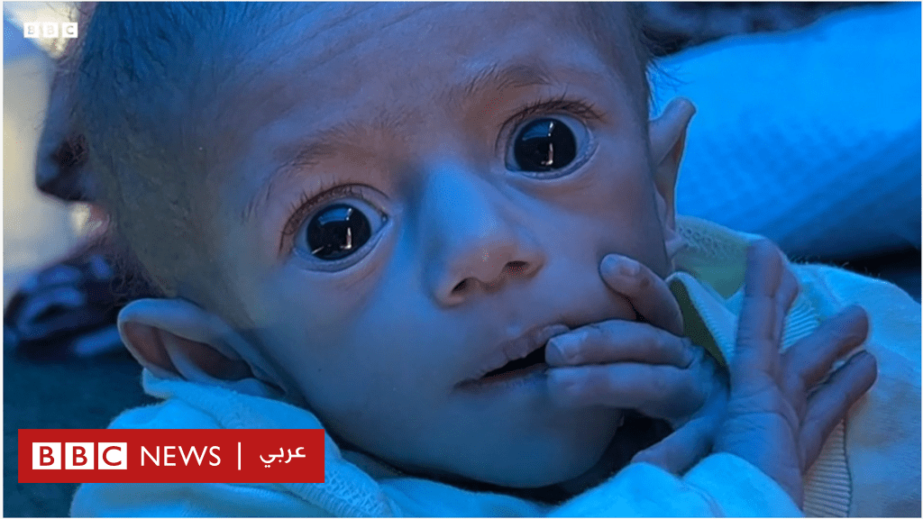 الرضيعة-سوار:-رحلة-معاناة-توثّق-الجوع-والحصار-في-غزة