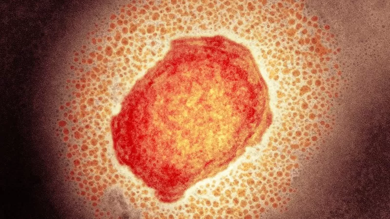 تم تأكيد عشرين حالة إصابة بجدري القرود في بريطانيا SCIENCE PHOTO LIBRARY