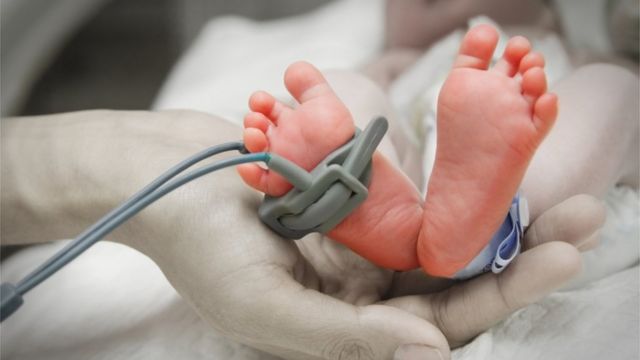 الحمل:-لماذا-حافظت-أمهات-على-أجنتهن-رغم-إصابتها-بمتلازمة-داون؟