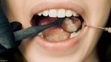 وجود قرحة على الشفتين قد يكون علامة على سرطان الدم
