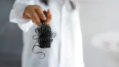 تعبيرية عن تساقط الشعر (أيستوك)